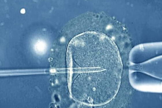 孕格鲁吉亚际试管婴儿好吗__格鲁吉亚助孕安全吗