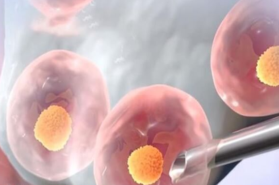 格鲁吉亚助孕妈妈移植_孕格鲁吉亚际试管婴儿好吗_