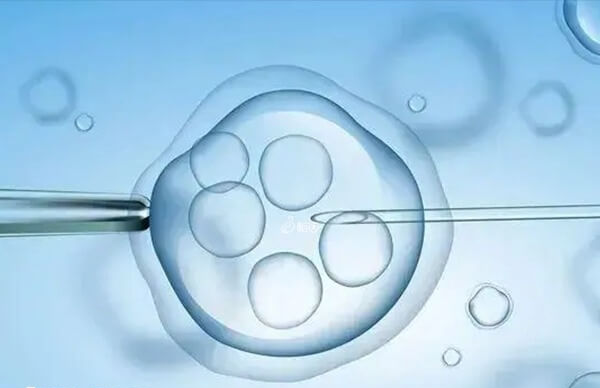 格鲁吉亚拥有几家知名的试管婴儿医院