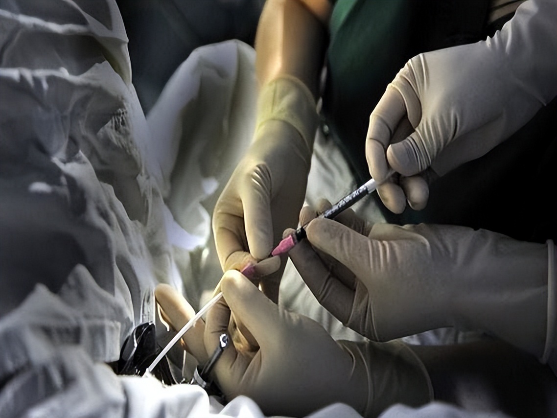 俄罗斯代孕产业链_格鲁吉亚卵子交易_格鲁吉亚助孕合法中介