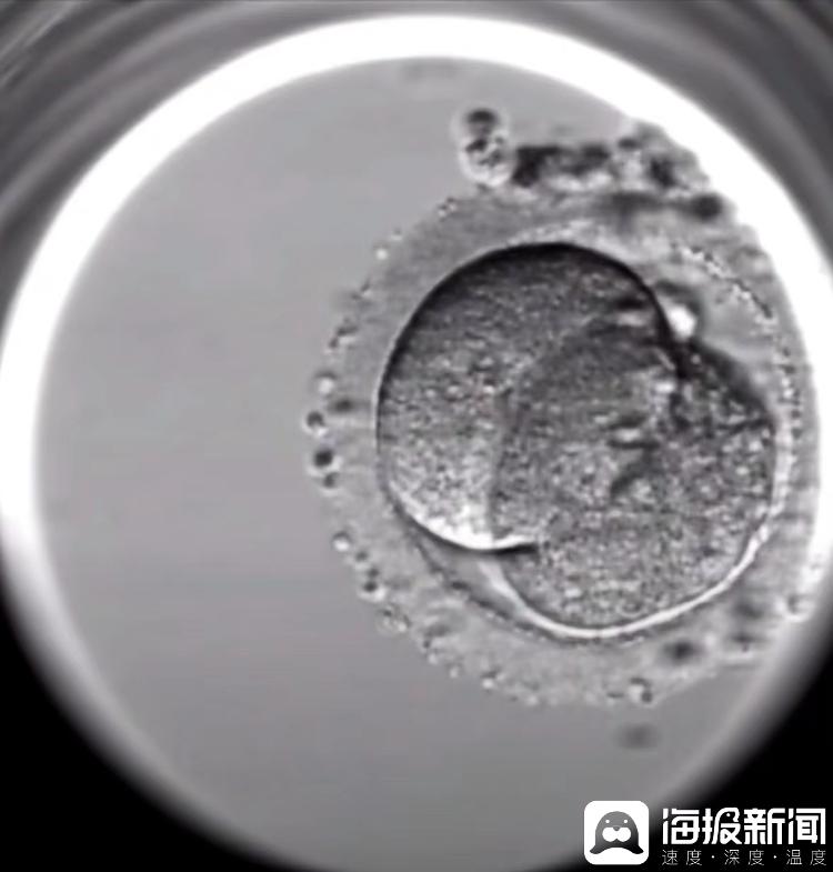 广西试管婴儿费用医保报销_格鲁吉亚助孕价格明细表_试管婴儿纳入医保政策解读
